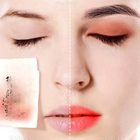 CLEANSER